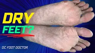 Dry Feet?: Foot Care In Winter