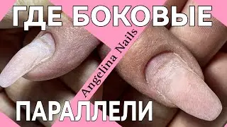 DEFORMED NAILS / no lateral parallels / EXTENSION of nails on paper templates /