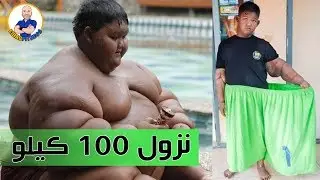 أسمن طفل بالعالم ينحف 100 كيلو مع رجيم صحي | World's heaviest kid