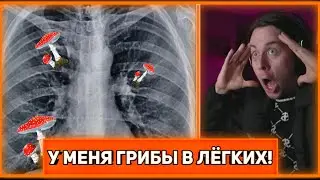 ГРИБЫ В ЛЕГКИХ ФРАМЕТАЙМЕРА!!!!!