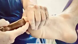 Deep foot massage reflexology using strong Thai massage tools. Brandon massaging Richard’s foot pt3.