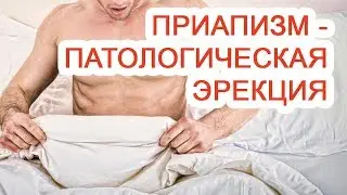 Приапизм – патологическая эрекция / Доктор Черепанов