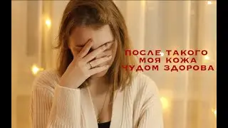 уход за кожей || 10 ошибок при борьбе с акне