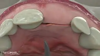 Avance del vídeo completo 