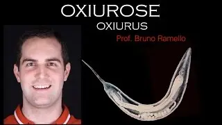 Verminoses - Oxiurose ou Oxiurus
