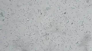 Human sperm under a microscope (X40)
