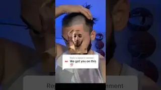 LOSING HAIR!? 