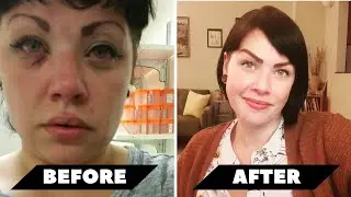 Woman Ends Severe Addiction Of 20+ Years After An Overdose Near Death Experience | NDE