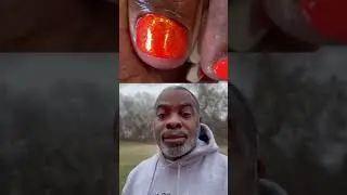 Nail Technician/Podiatrist Relationship 