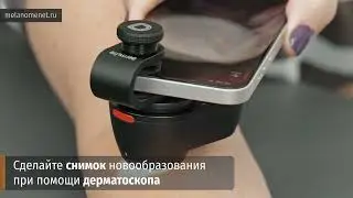 Сервис цифровой диагностики кожи 24/7 в Вашем кармане!