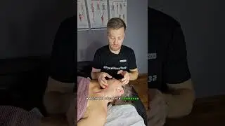 Признак фиброзной ткани на лице