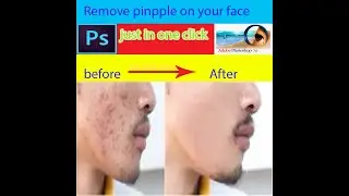 how to remove pimples in photoshop in just 2 mintes|photoshop tutorials