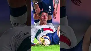 🔴 Ronaldo Revenge in Football ⚽                                     