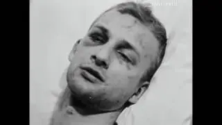 This man was beaten during the Freedom Rides, 1960...