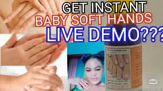 GET RID OF DARK KNUCKLES IN 10 MINUTES NO JOKE WORKS 100%| GET RID OF DARK KNUCKLES WITH FONGICIDE