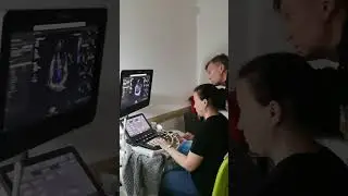 Тренинг по УЗИ в кабинете у доктора Молова.
