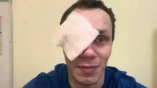 Korney Tarasov lost an eye...