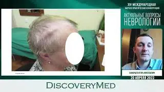 Нейровизуализационные корреляты когнитивных нарушений