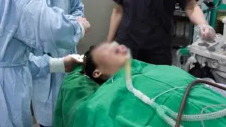 성형수술