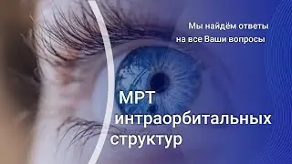 МРТ интраорбитальных структур