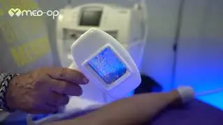שף צ'רלי פדידה בהרת שיער ע