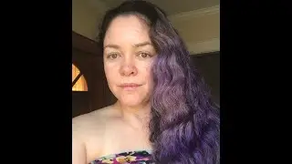 Cómo cuidar herida de Cirugía/ mi experiencia/ así quedó la cicatriz /ROsy ROsy