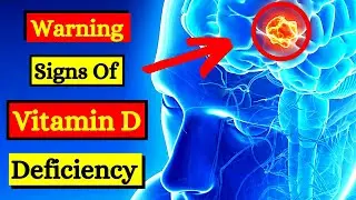 10 Signs Of Vitamin D Deficiency