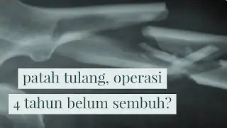 patah tulang, sudah operasi 4 tahun belum sembuh?