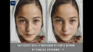Tutoials- Skin Retouching In PhotoShop Tutorials Episode- 4