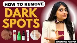Dark Spots Treatment | How to remove dark spots| Dark spots on face removal | Dermatologist tips