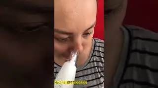 HIGH-END PORTABLE ACNE VACUUM CLEANER