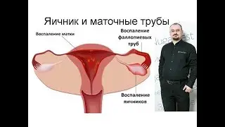 Болезни яичника и маточных труб.