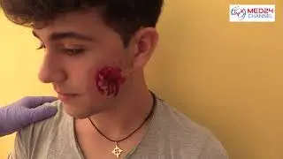 Cerignola: 