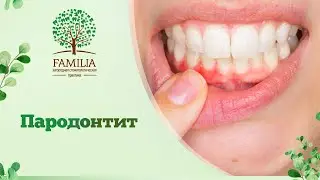 😕 Пародонтит / Что такое пародонтит и причины возникновения / Можно ли вылечить пародонтит?