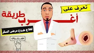 أغرب طريقة بحثية لعلاج جروح السكري