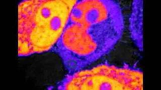 FLIP in HeLa cells expressing EYFP