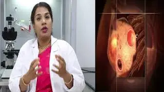IUI விந்தணு செலுத்தும் சிகிச்சை || 3D Video || ARC Fertility Hospital (Chennai - Perambur)