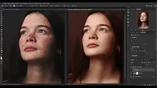 Copie Qualquer Tom de Pele - Tratamento de pele