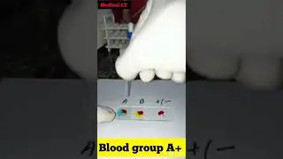 Blood group A positive | blood group A #shorts #doctorsvlog #bloodgroup #viral