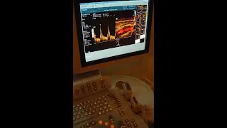 Industrial Instrumentation Tutorial 8 - Flow Measurement 6 - Ultrasonic Flow Meter