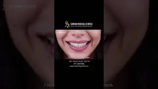 השתלת שיניים בטכנולוגיה מתקדמת – סביון מדיקל סנטר
