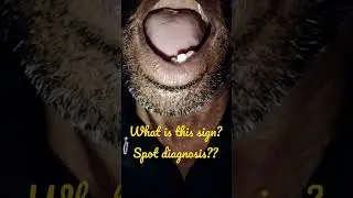 Which sign is this? 
