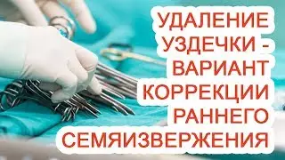 Удаление уздечки – вариант коррекции раннего семяизвержения / Доктор Черепанов