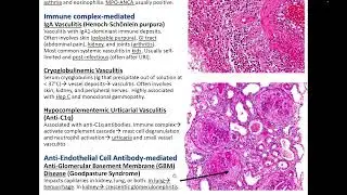Vascular Disease: Kurt's Notes #pathagonia