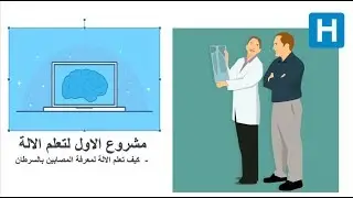 Two Class classification - مشروع الاول لتعلم الالة: -3 كيف تعلم الالة لمعرفة المصابين بالسرطان