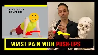 Can't do push-ups WRIST PAIN Treat the Scaphoid