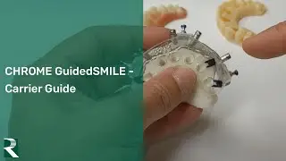 CHROME GuidedSMILE - Carrier Guide