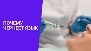 ПОЧЕМУ ЧЕРНЕЕТ ЯЗЫК