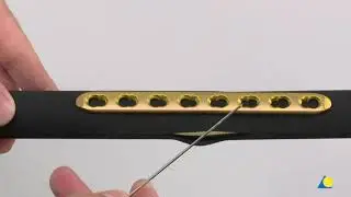 Principles of Internal Fixation with Screws and Plates