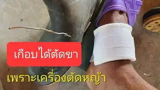 อันตรายจากเครื่องตัดหญ้า...เกือบได้ตัดขา